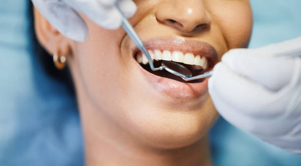 Best Dental Abscess Treatment in Hubbard, OR